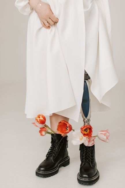 Elegant portrayal of a prosthetic leg with vibrant tulips in minimalist style.