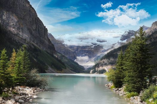 Stunning landscape featuring Lake Louise with majestic mountain backdrop and lush greenery.
