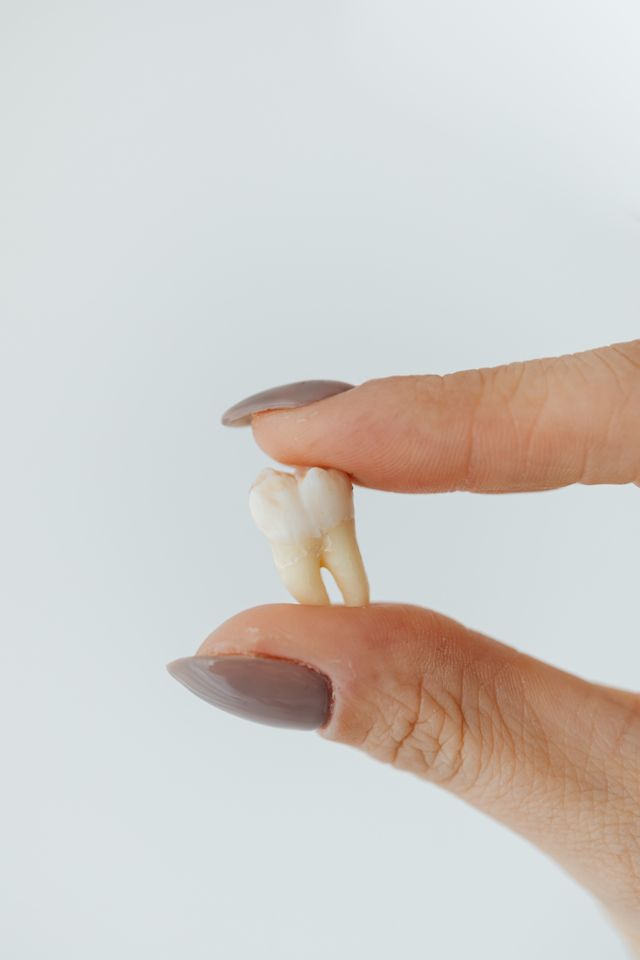 Dental bridge illustration