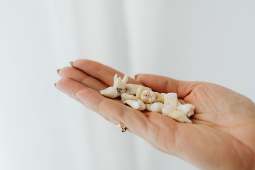 Close-up image of human teeth held in a hand, set against a white background.