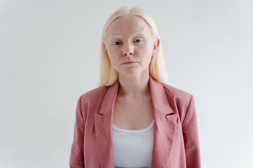 Gratuit Photos gratuites de albinos, blond, femme Photos