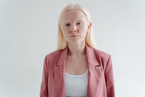 Kostnadsfri bild av albino, blond, kaukasisk kvinna