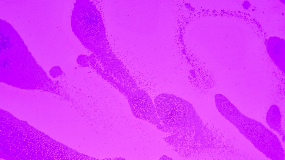 Close-up of a bright pink abstract background with bubble textures, ideal for wallpapers and artistic designs.