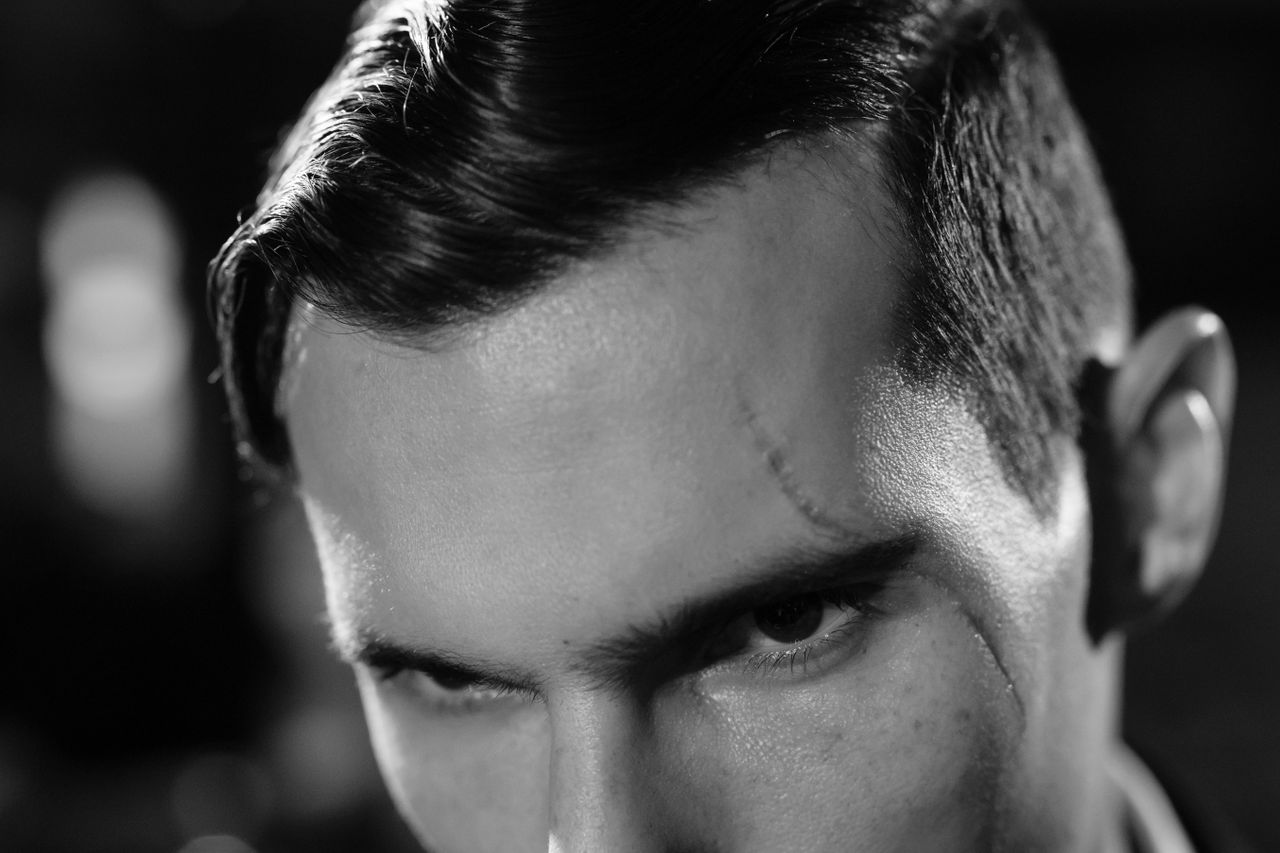close up black and white portrait highlighting a scarred face with a m