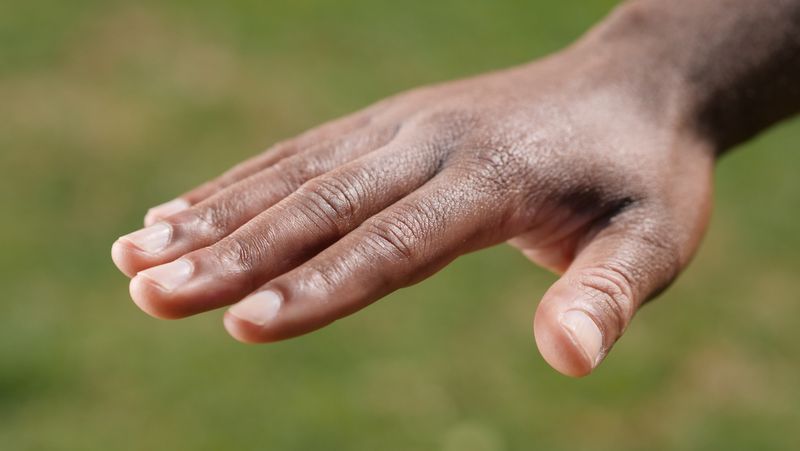 A brown hand reaches out with fingers extended, the skin naturally darker over the knuckles.