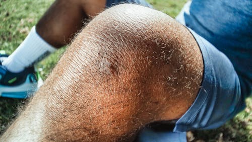 Free Close-up Shot of a Wounded Knee Stock Photo