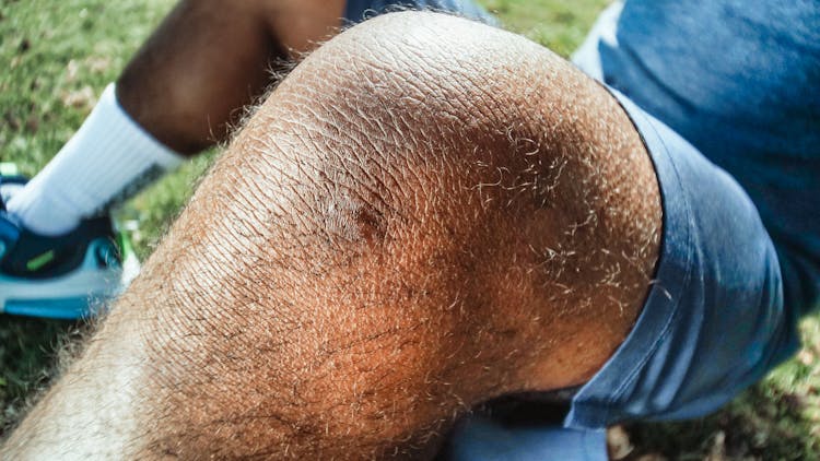 Close-up Shot Of A Wounded Knee