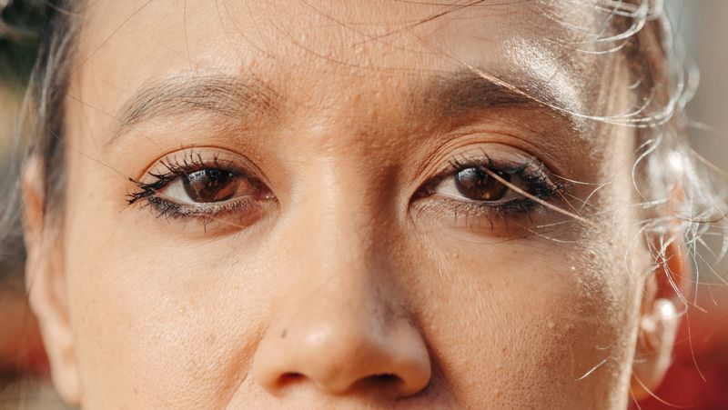 Close-up de pálpebras para blefaroplastia