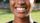 teeth