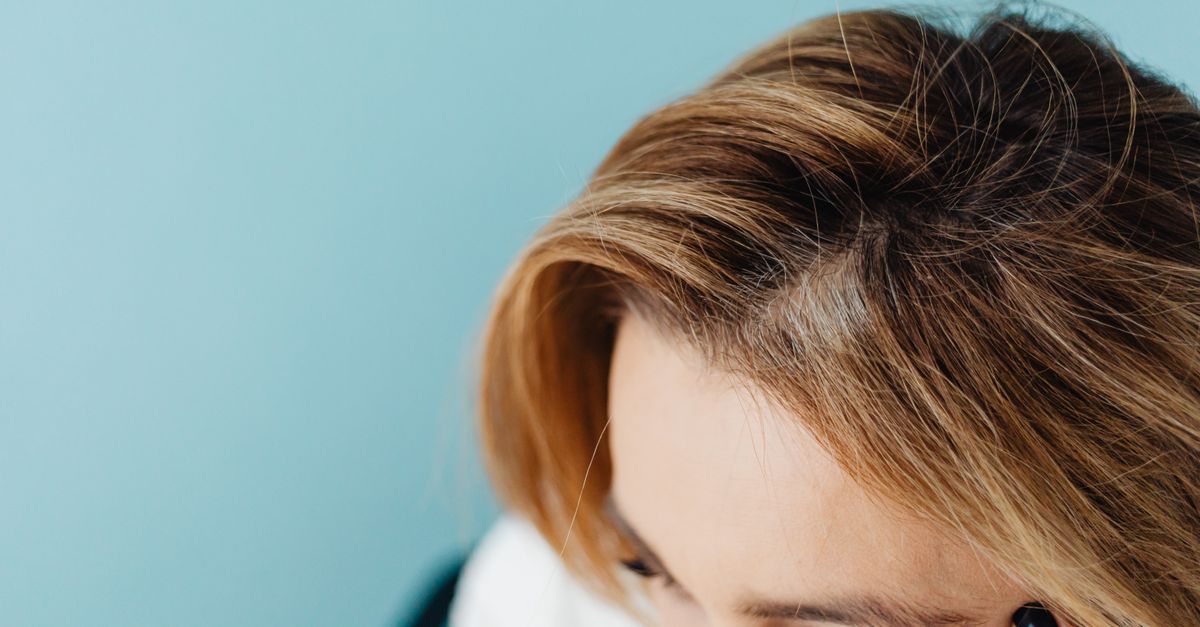 Photo: https://kaboompics.com/ / Pexels Beauty brands expand products addressing hair loss as a growth category