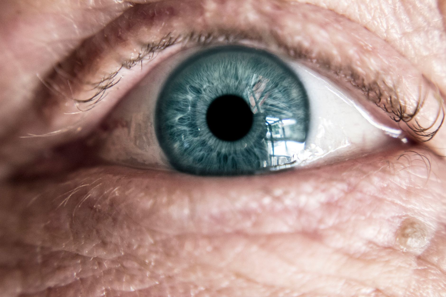 Cataract Surgery: How Long Do the Results Last?