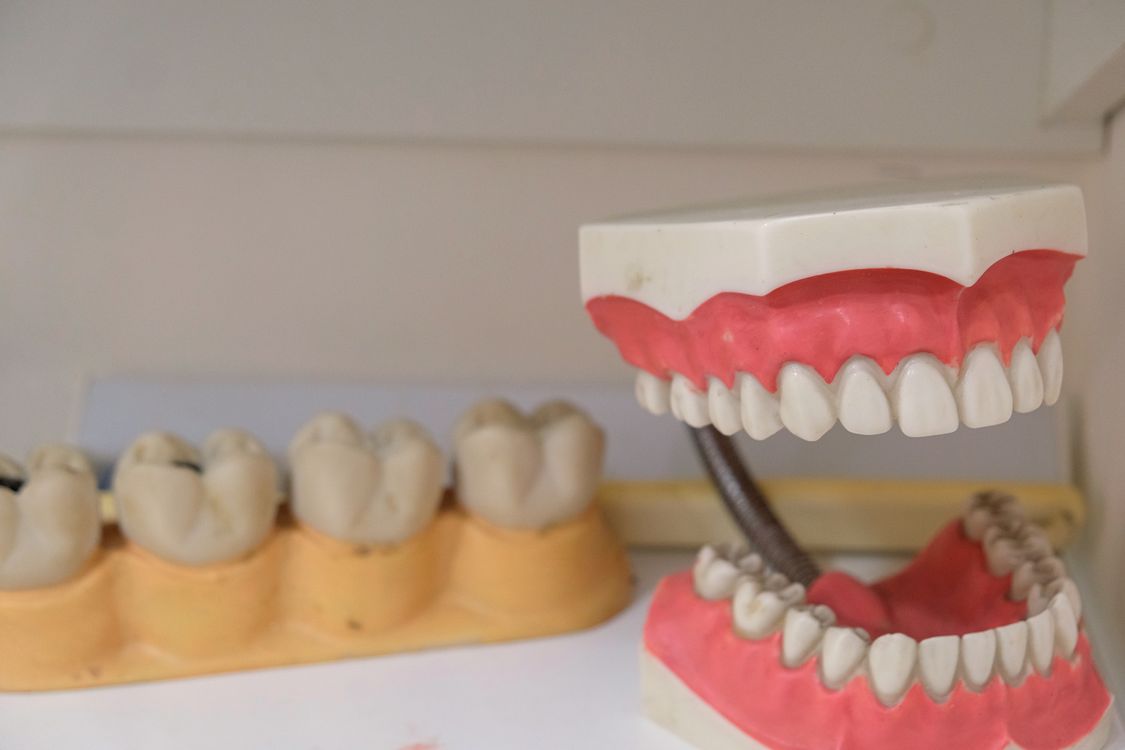 Close-up of dental cast models and prosthetic dentures on display, used for dental education and smile planning