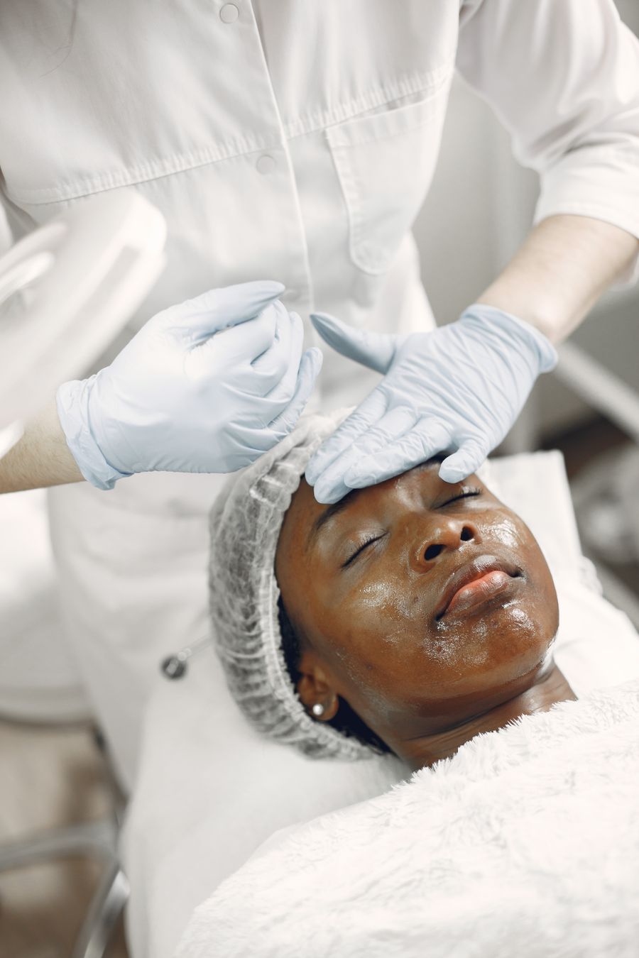 Resultado de tratamento facial