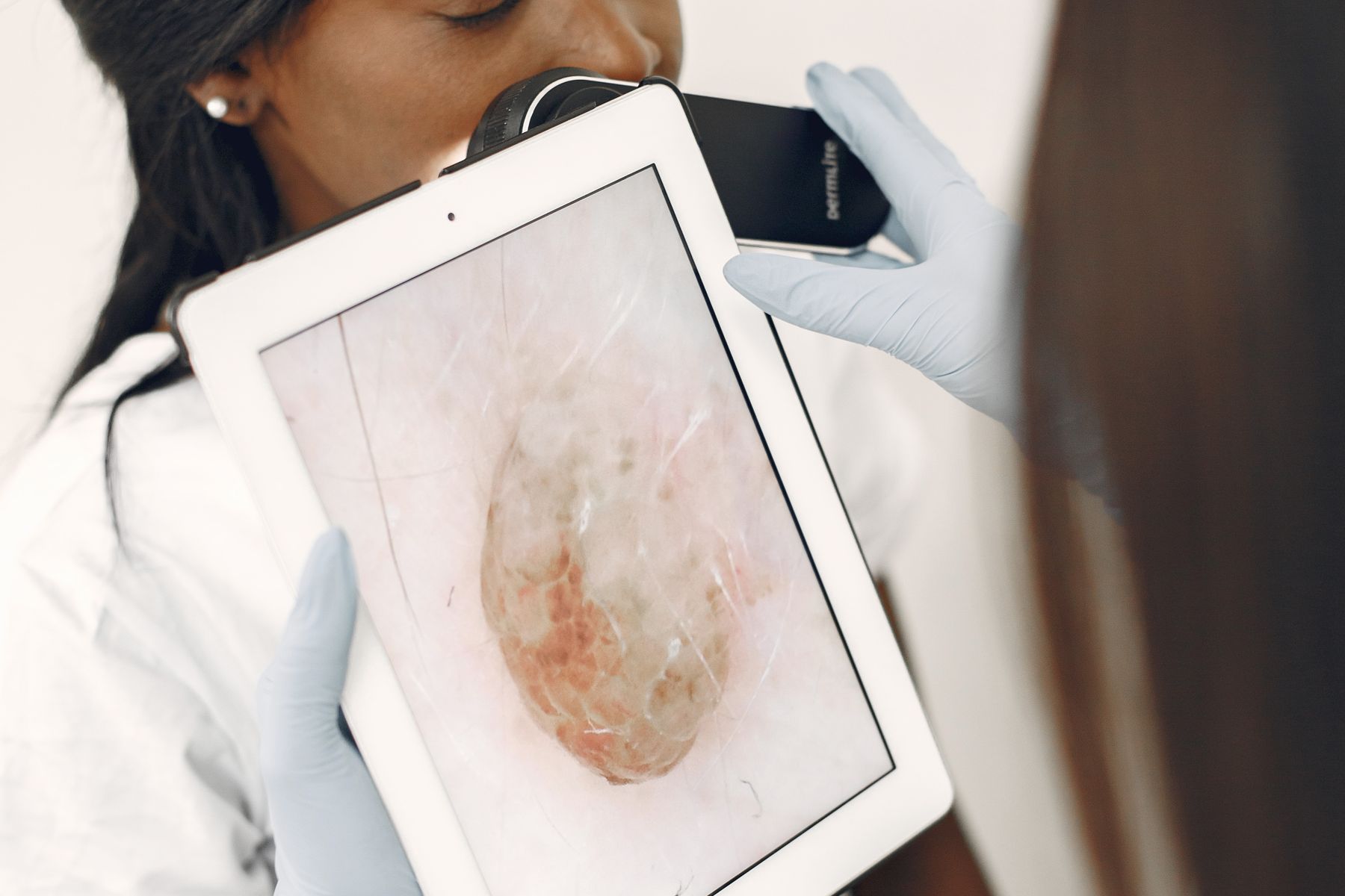 Dermatology clinician examining a patient’s skin with digital tools in a modern private clinic