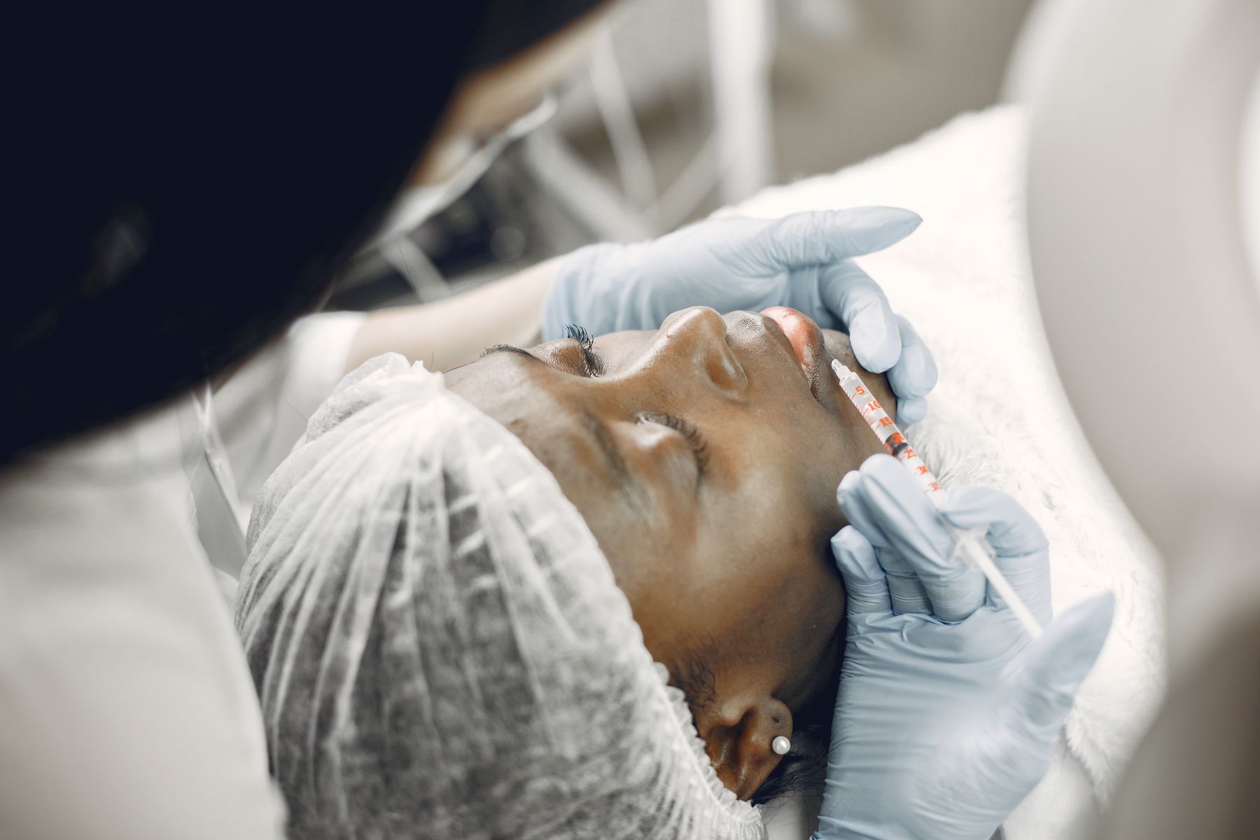 PRP facial treatment
