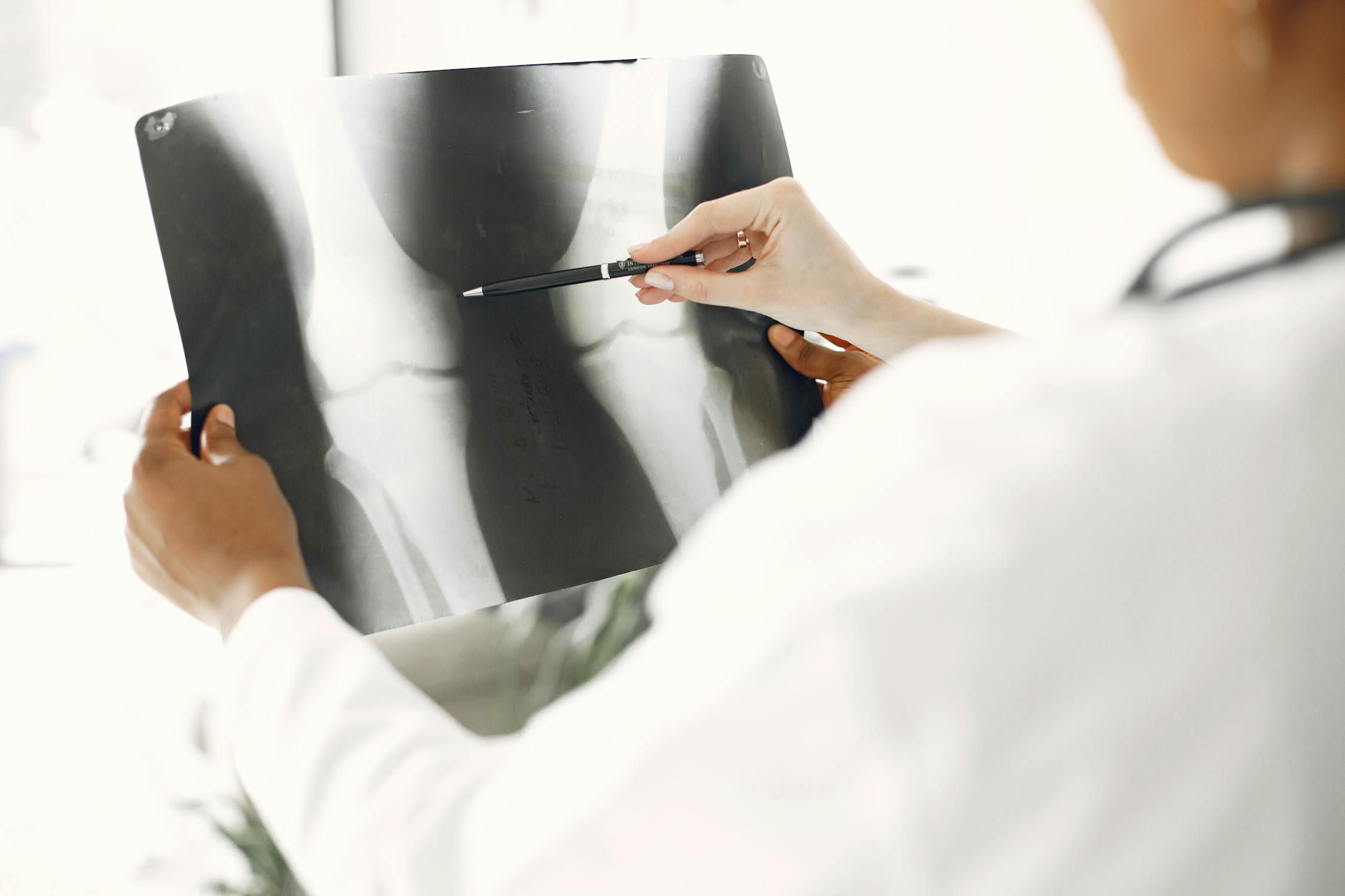 Physician looking at bone scan Physician looking at bone scan