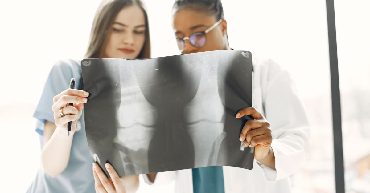 Real-World Use of HL7-CDA LLM in ICD-10-CM Coding Examined