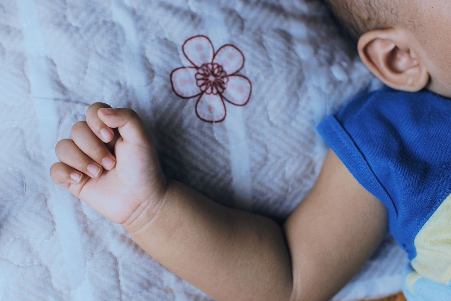 Understanding Hemangiomas: A Guide for Indian Readers