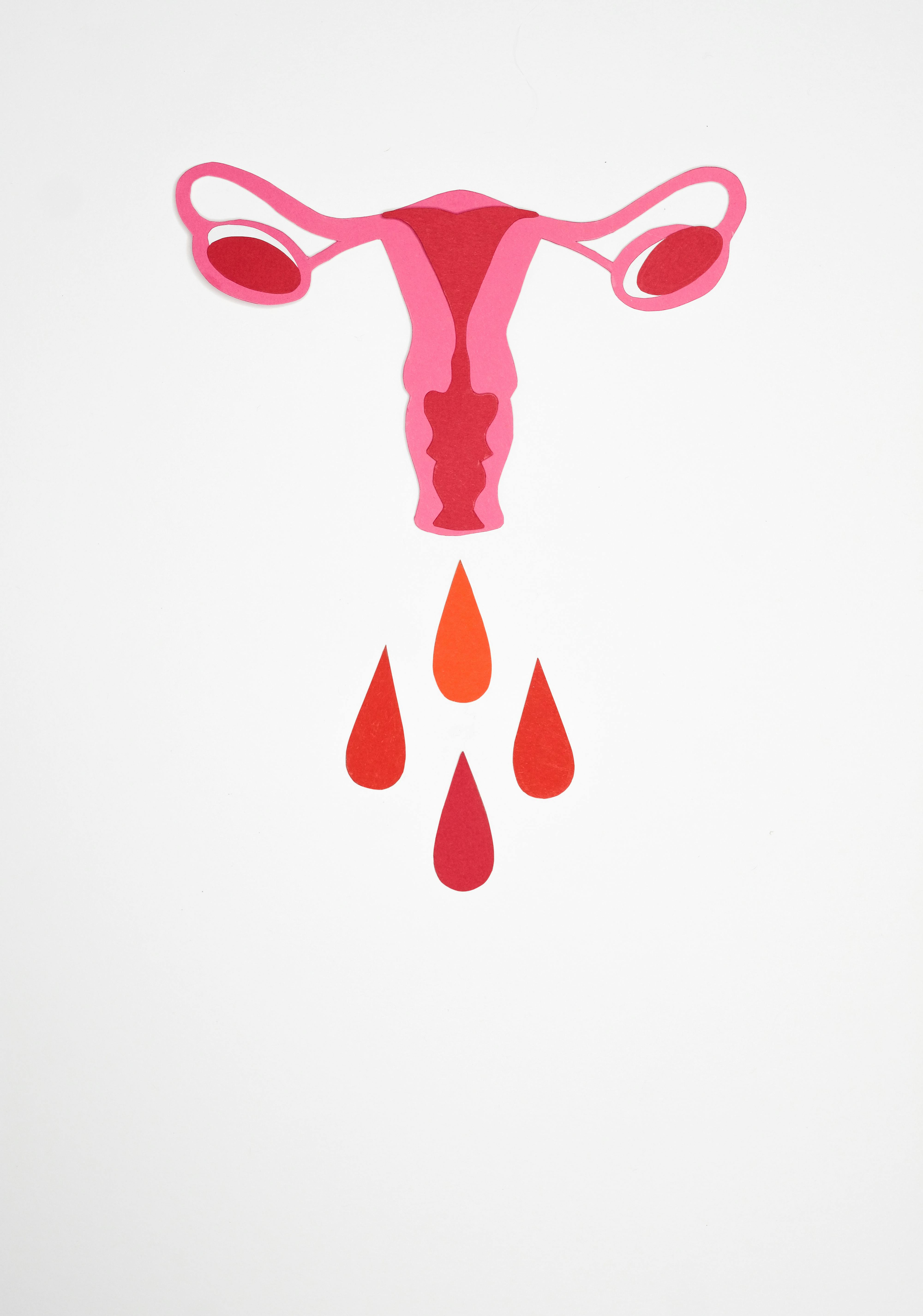 Abnormal Vaginal Bleeding