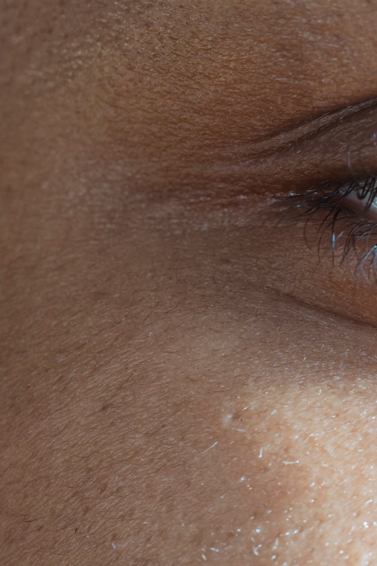 Human Skin Near Eyelashes