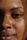 oily skin
