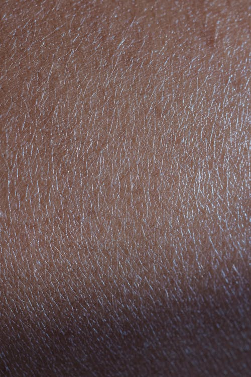 Close Up Photo of a Dry Human Skin
