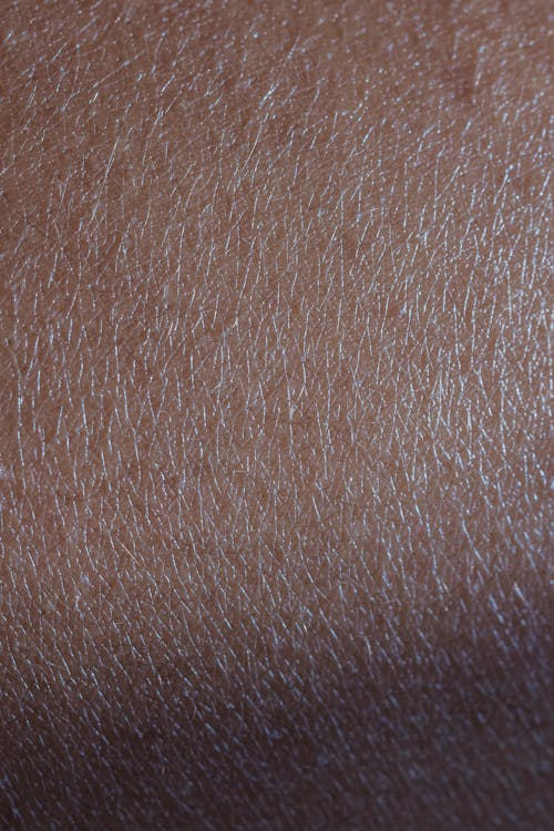 Close Up Photo of a Dry Human Skin