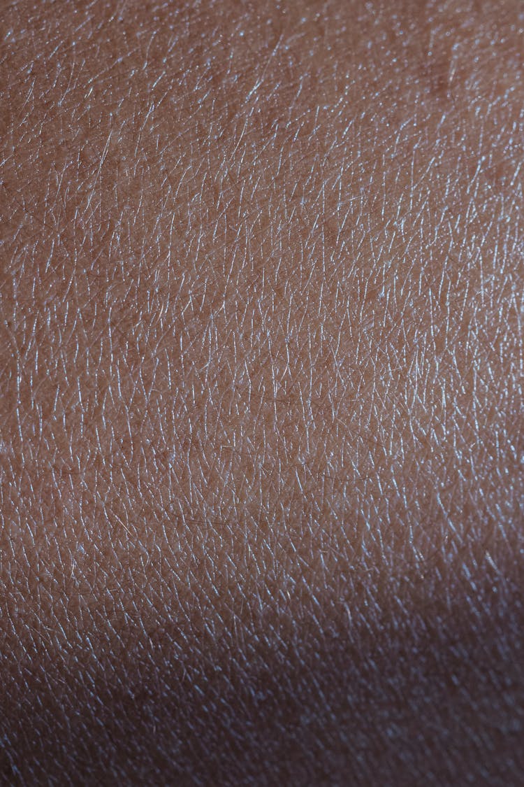 Close Up Photo Of A Dry Human Skin