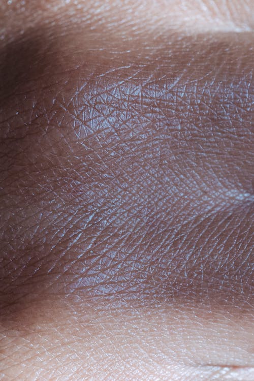 Close Up Photo of a Person's Skin