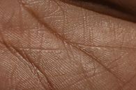 Close Up Photo of Human Skin
