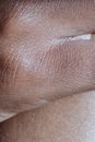 Human Skin in Close Up Photography