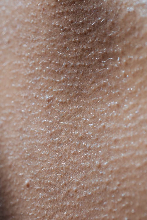 Close Up Photo of a Human Skin