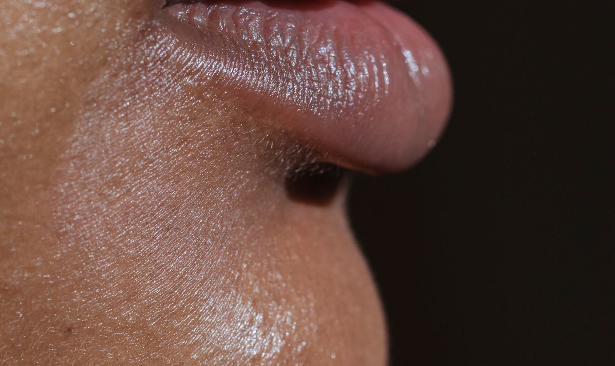 Primer plano de labios con acabado natural, relleno de labios en Sapphira Privé Montecarmelo