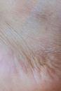 Human Skin With Hair on the Camera