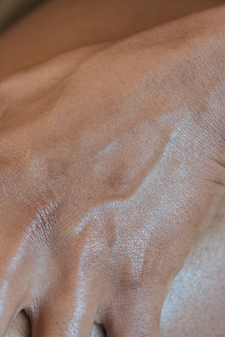 Veins On Hand Skin