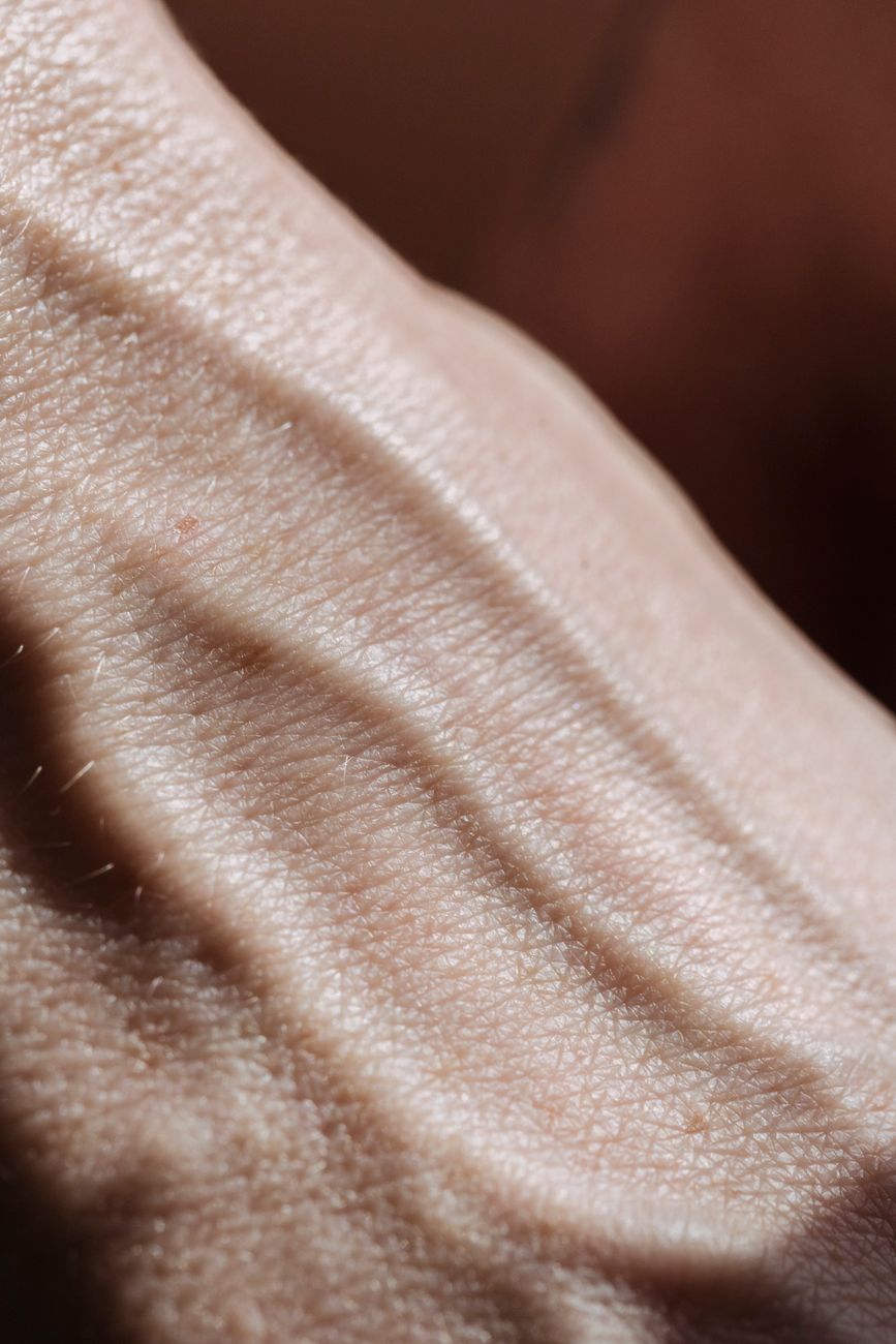 Data-Driven Skin Texture Improvement Plan: Pore Refinement Strategies After AI Facial Analysis