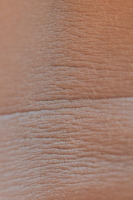 understanding the Science of Aging Skin and Its Needs