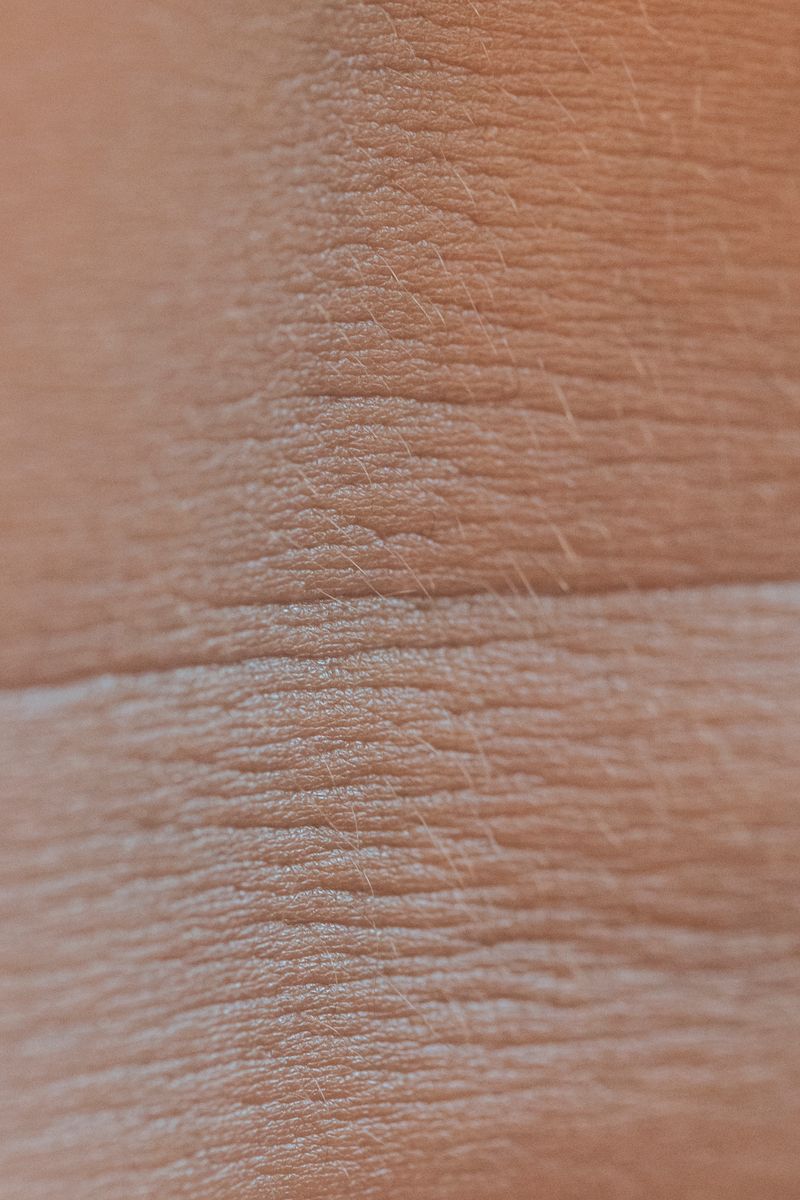 Skin texture and aging — Dr. Chloé Ward