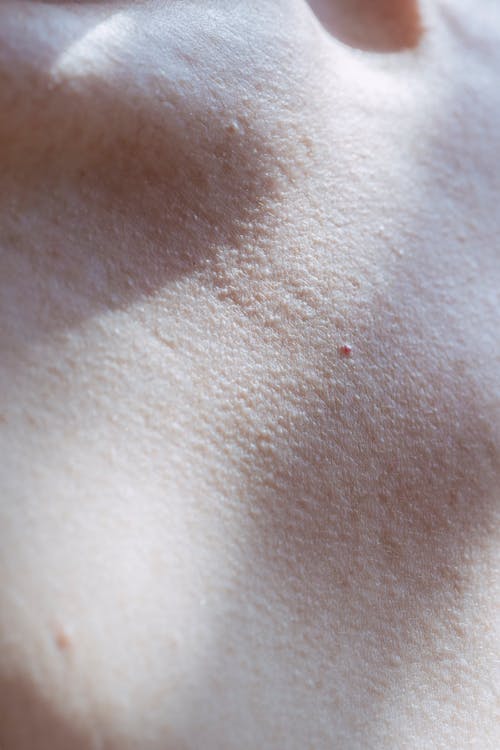 Photo of Human Skin 