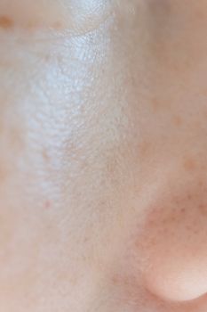 Detailed close-up image highlighting the texture and pores of human skin.