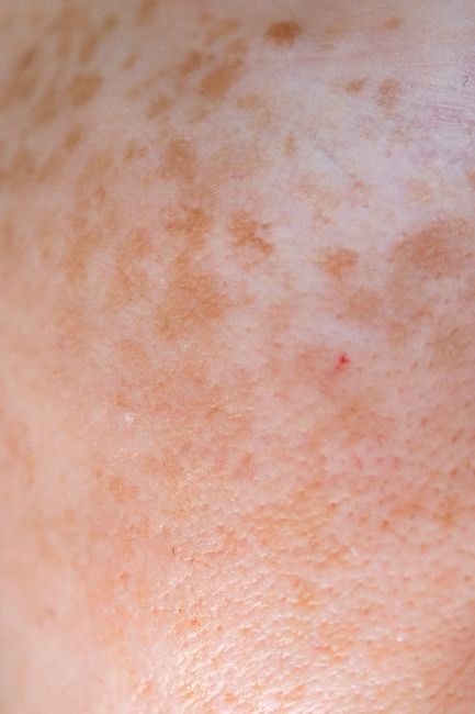 Expert Recommendations for Every Skin Type