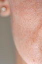 Close Up Photo of Human Cheek