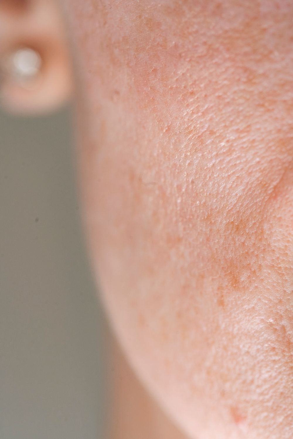 Close Up Photo of Human Cheek · Free Stock Photo