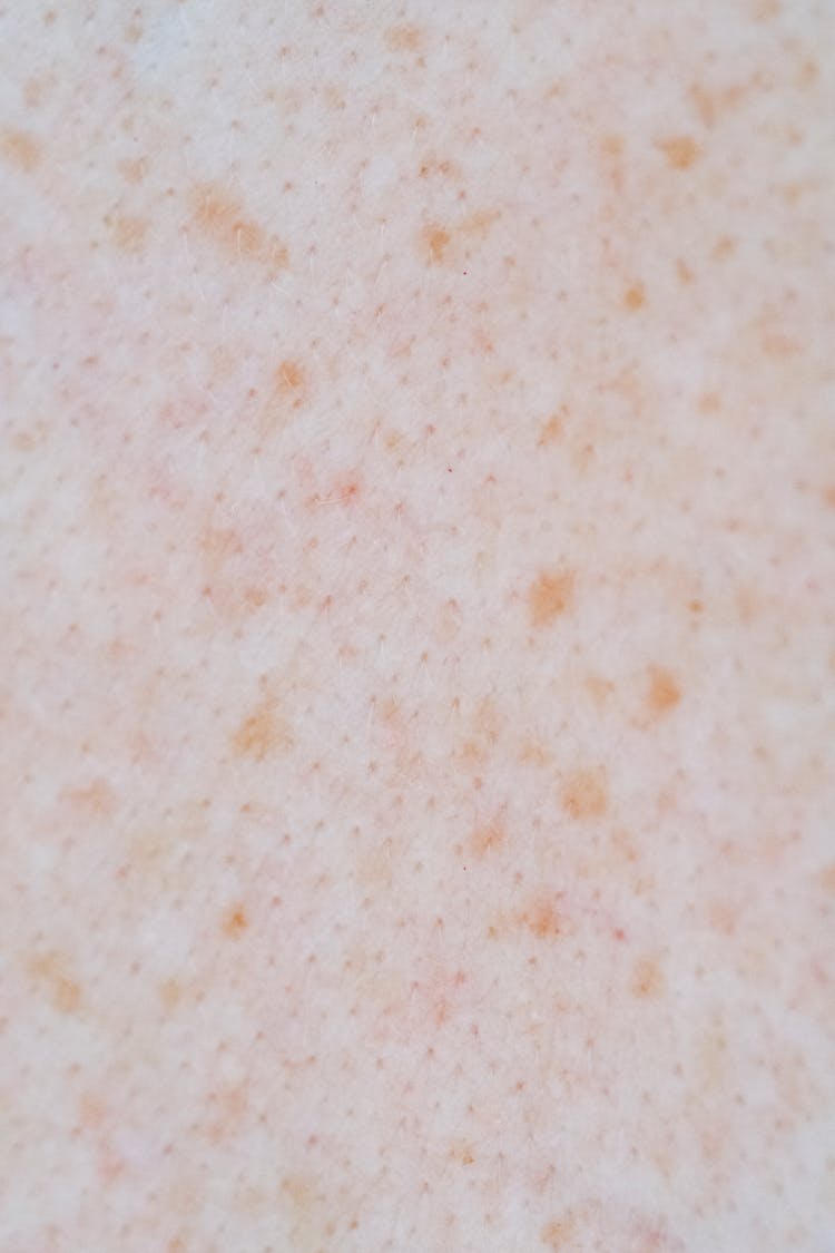 Extreme Close Up Of Skin