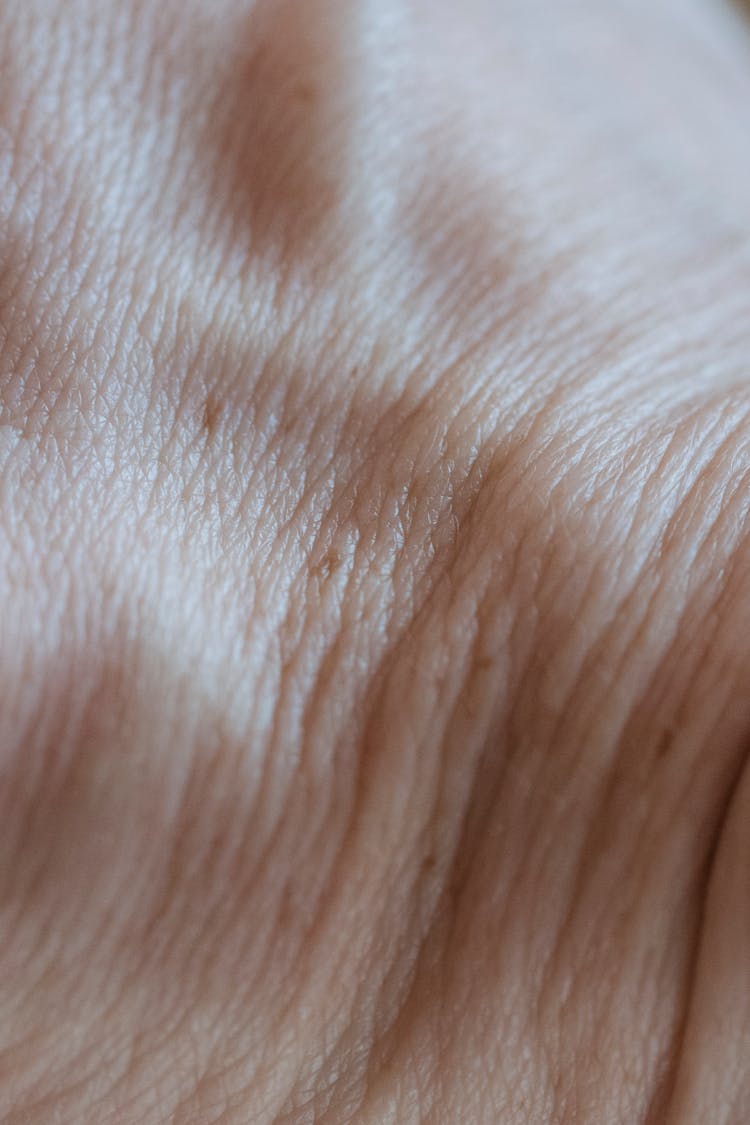 Hand Of Faceless Person With Veins