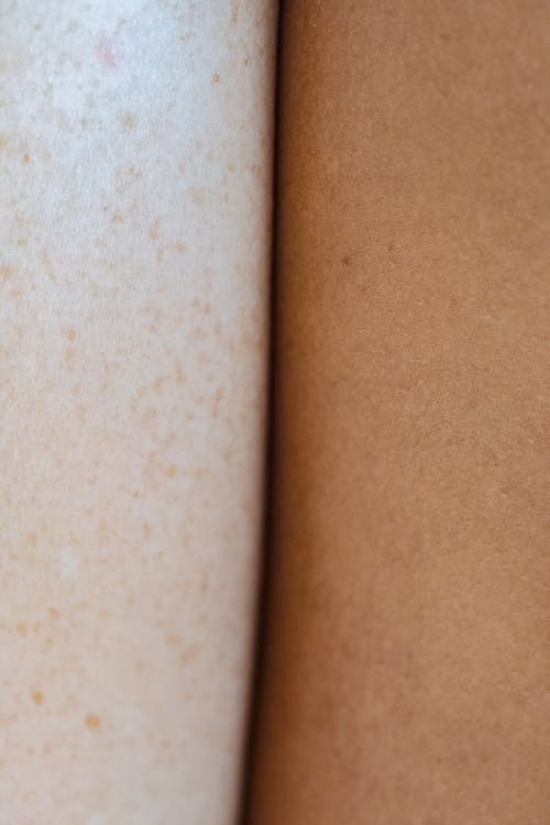 Closeup arms of crop diverse anonymous people with small pigment dark spots standing close to each other in light room