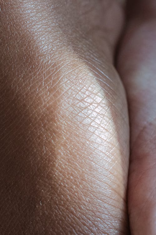 Closeup of crop anonymous person showing natural imperfect dry hands skin at daylight