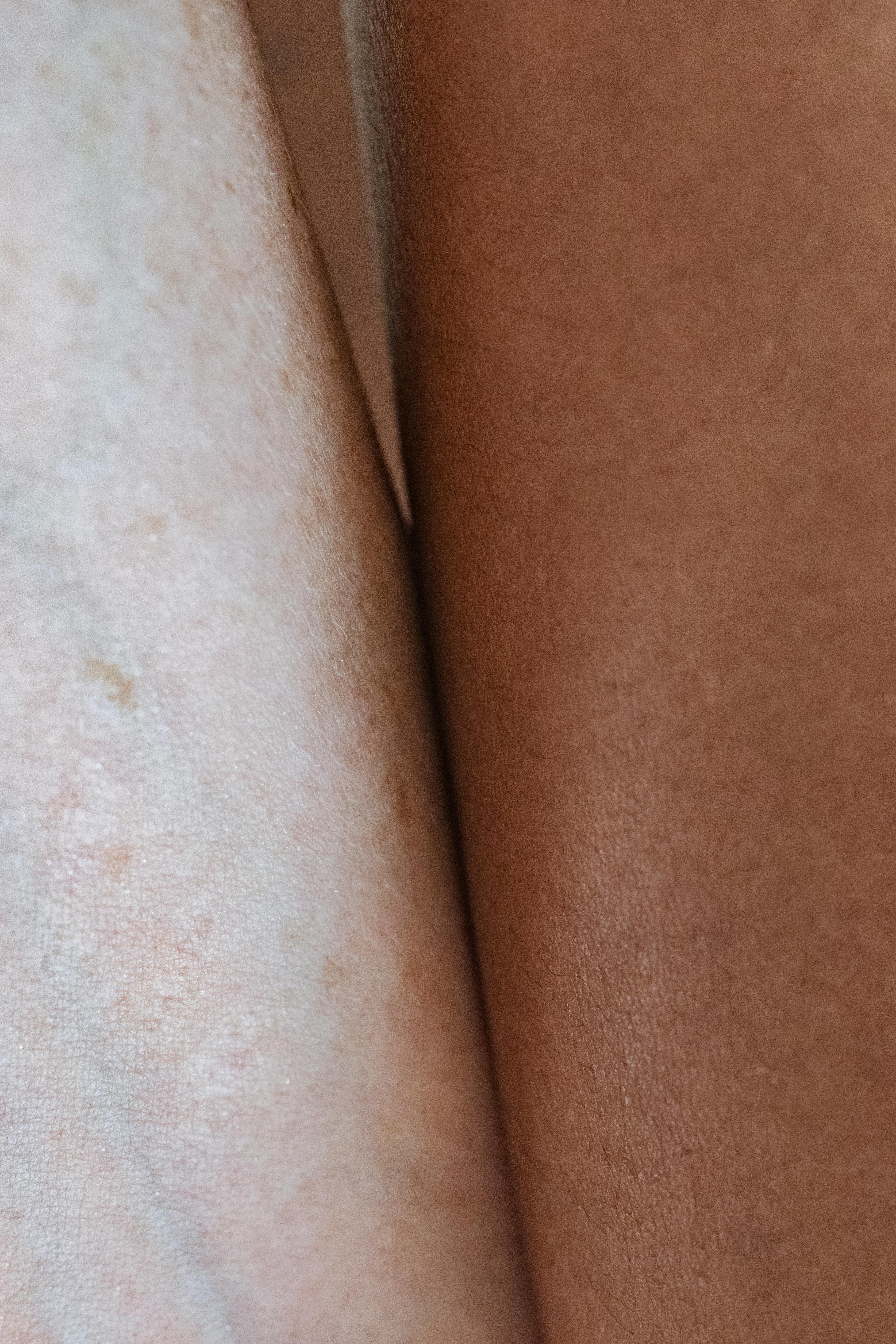 woman with smooth skin near black model