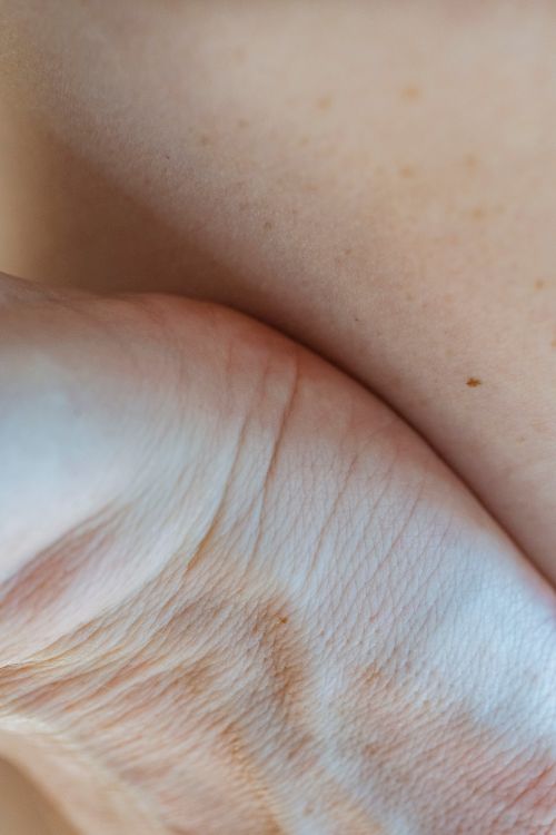 Free Closeup of crop anonymous female with imperfect natural skin touching nude body with birthmarks Stock Photo