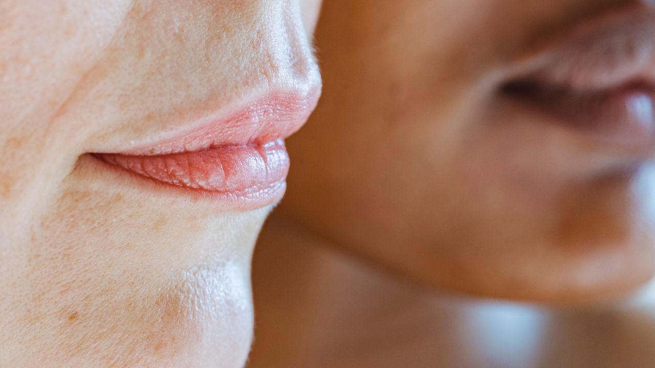 Preenchimento Labial em Jaú: Vale a Pena Investir em Lábios Harmoniosos e Naturais? - Augusta Perfection